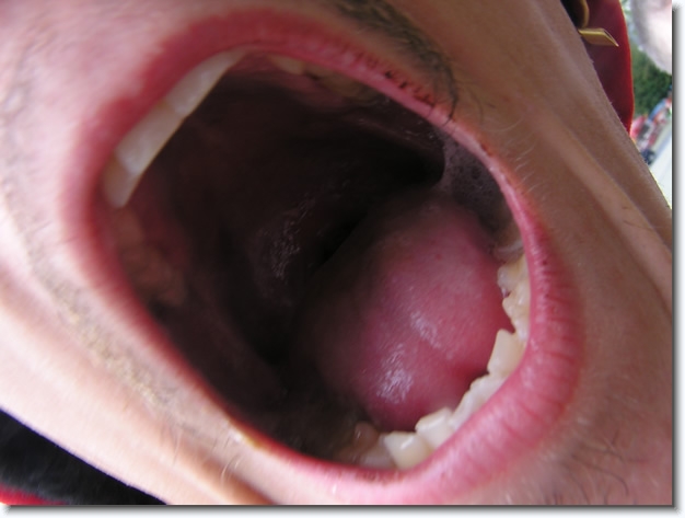 Diapositive suivante