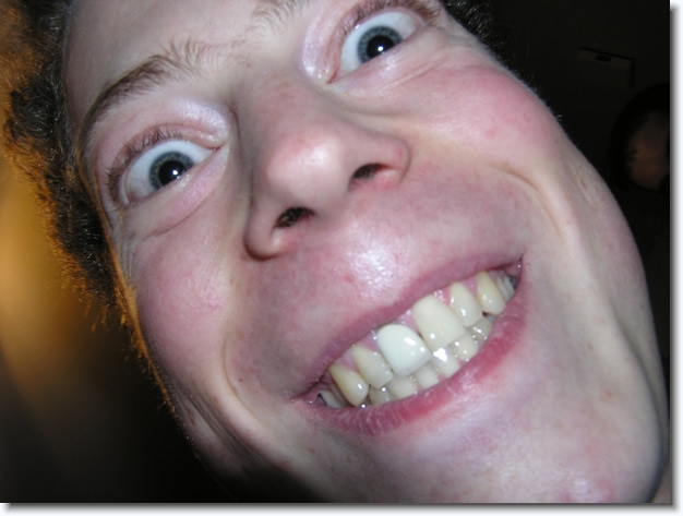 Diapositive suivante