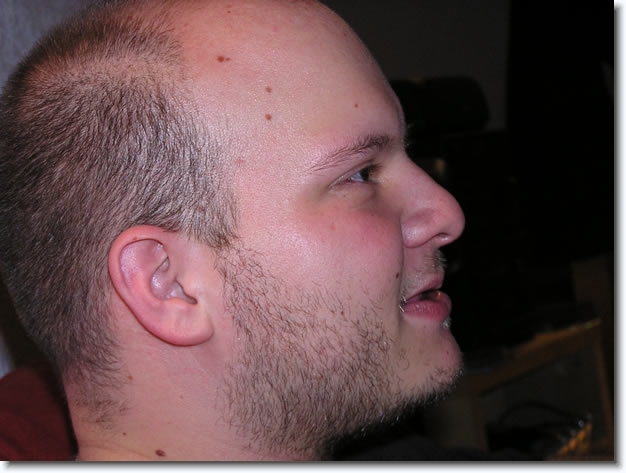 Diapositive suivante